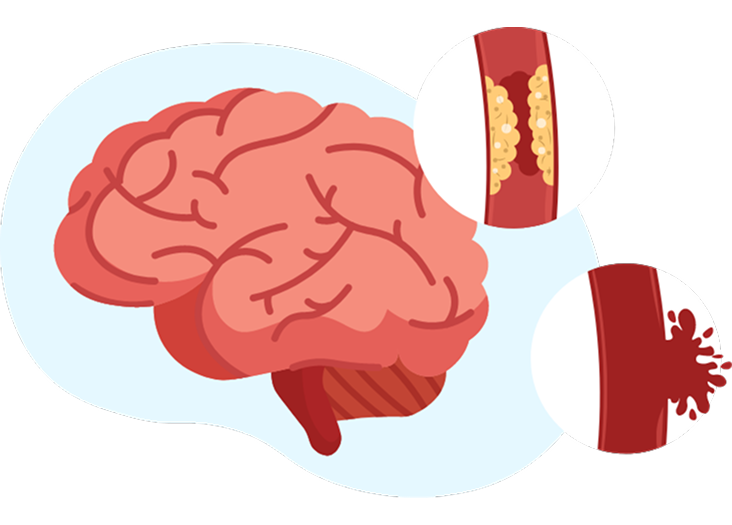 content-2 content-2